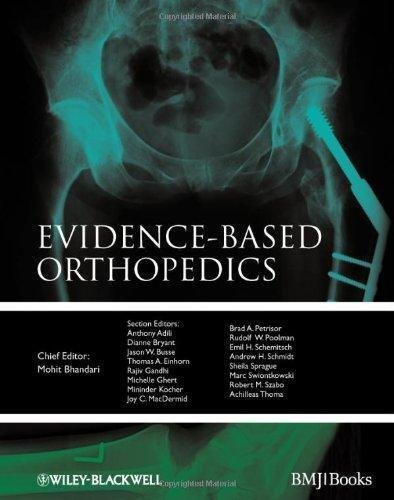 Evidence Based Orthopedics Evidence Based Medicine by Mohit Bhandari Series: Evidence-Based Medicine  1 edition (December 27, 2011)  Language:English -