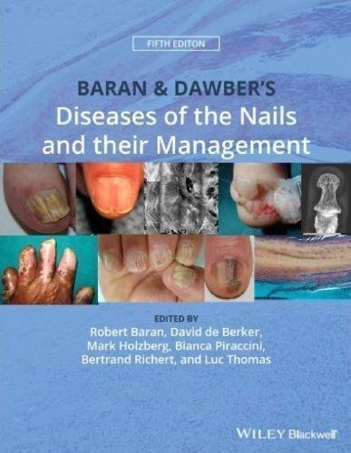 Baran Dawbers Diseases Of The Nails And Their Management 5Th Edition by Robert Baran, David de Berker, Mark Holzberg, Bianca Maria Piraccini, Bertrand Richert, Luc Thomas - 978-1-119-32335-8