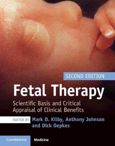 Fetal Therapy Scientific Basis And Critical Appraisal Of Clinical Benefits 2Nd Edition by Mark D. Kilby (editor), Anthony Johnson (editor), Dick Oepkes (editor)  2nd edition (January 2, 2020)  Language:English -