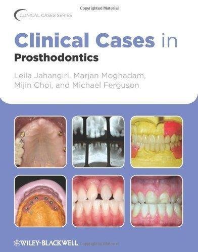 Clinical Cases In Prosthodontics by Leila Jahangiri, Marjan Moghadam, Mijin Choi, Michael Ferguson(auth.) - 978-0-8138-1664-7