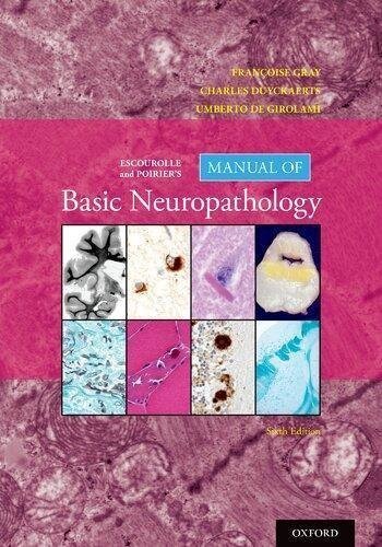Escourolle And Poiriers Manual Of Basic Neuropathology 6Th Edition by Francoise Gray MD (editor), Charles Duyckaerts MD (editor), Umberto de Girolami MD (editor) - 0190675012
