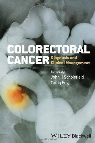 Colorectal Cancer Diagnosis And Clinical Management by John Scholefield, Cathy Eng - 0470674806