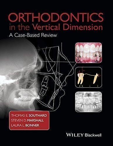 Orthodontics In The Vertical Dimension A Case Based Review by T. E. Southard, S. D. Marshall, L. L. Bonner - 1118870212