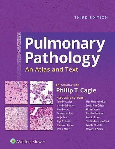 Pulmonary Pathology An Atlas And Text 3Rd Edition by Philip T Cagle, MD;Timothy C Allen, MD,JD;Mary Beth Beasley, MD;Alain Borczuk, MD Publisher: LWW; Wolters Kluwer, Year: 2018;2019 - 9781496346094