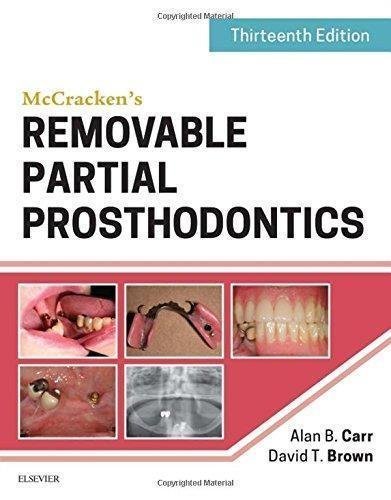 Mccrackens Removable Partial Prosthodontics 13Th Edition by Alan B. Carr DMD MS, David T. Brown DDS MS - 0323339905