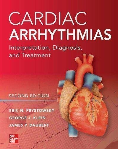 Cardiac Arrhythmias Interpretation Diagnosis And Treatment 2Nd Edition by Eric N. Prystowsky; James P. Daubert; (Professor of medicine) George J. Klein Year: 2020 - 9781260118216