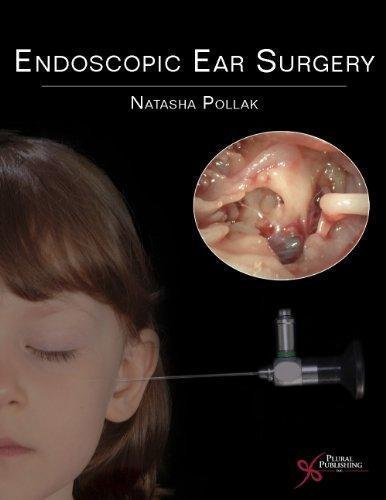Endoscopic Ear Surgery by Natasha Pollak - 1597565040